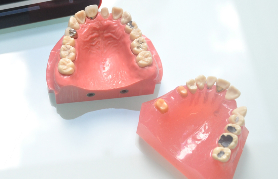 使用後の違和感に配慮した再調整