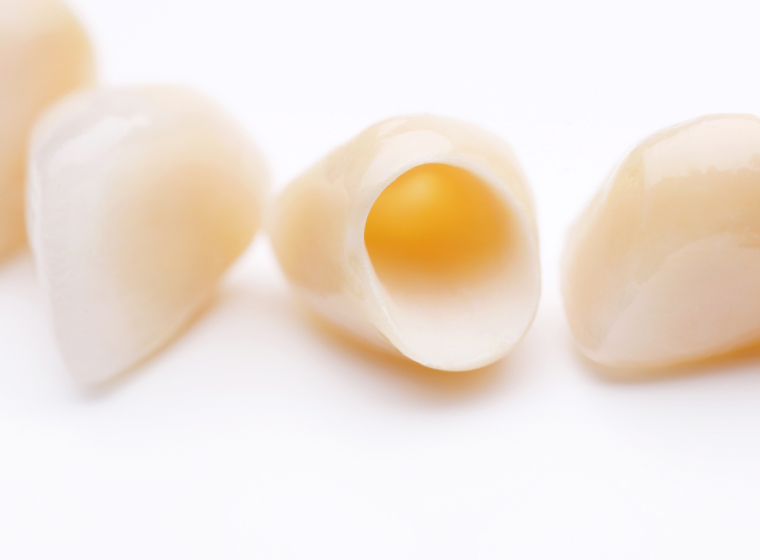 03 学んだ知識を活かした補綴と入れ歯治療への取り組み